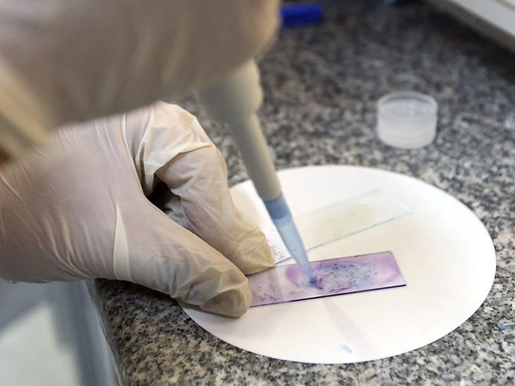 Biopsy Material (Small Size) (Less than 2.0 cm)