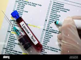Lipase