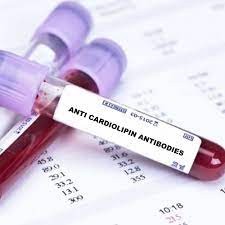 Cardiolipin Antibodies –IgA