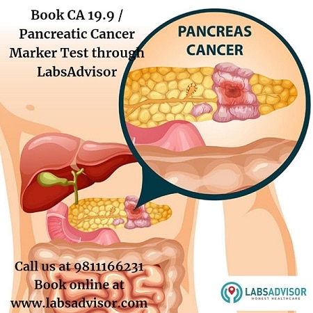 CA- 19.9 (Pancreatic Cancer Marker)