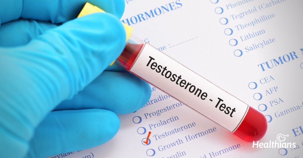 Testosterone- Free
