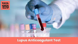 Lupus Anticoagulant