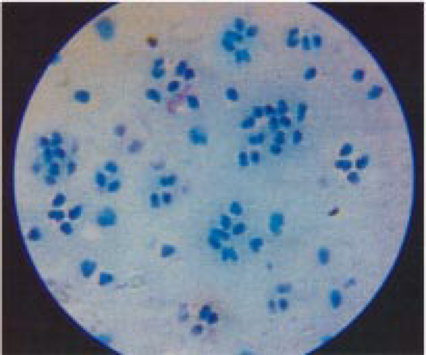Acid Fast Bacilli Stain (Z. N. Stain)
