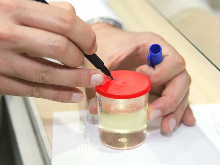 Protein Electrophoresis (24 hr Urine)