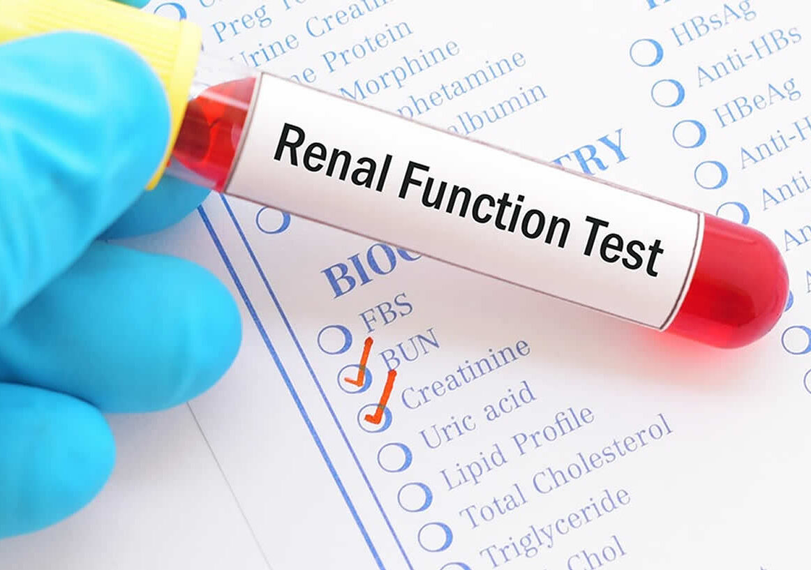 Complete Kidney function Test (Complete KFT)