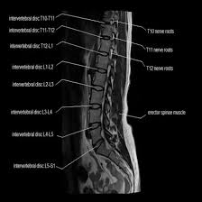 MRI Dorsal spine (D Spine)