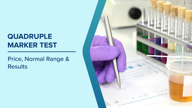 Quadruple Marker Test